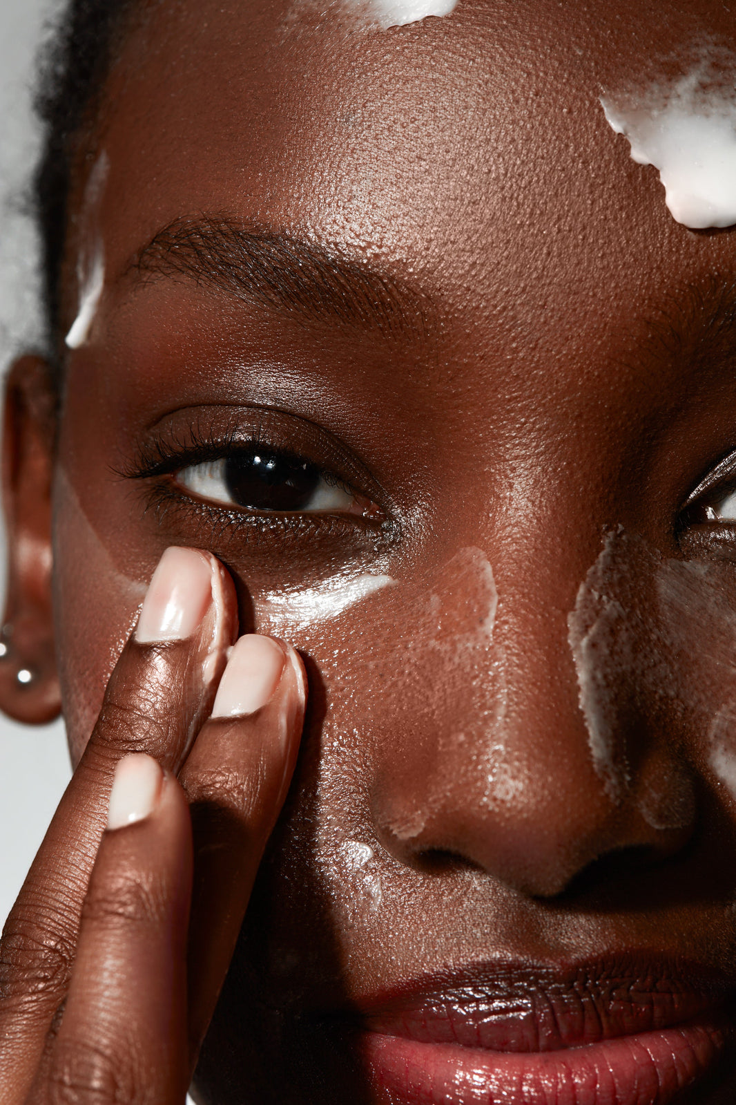 Why Hyperpigmentation Keeps Coming Back