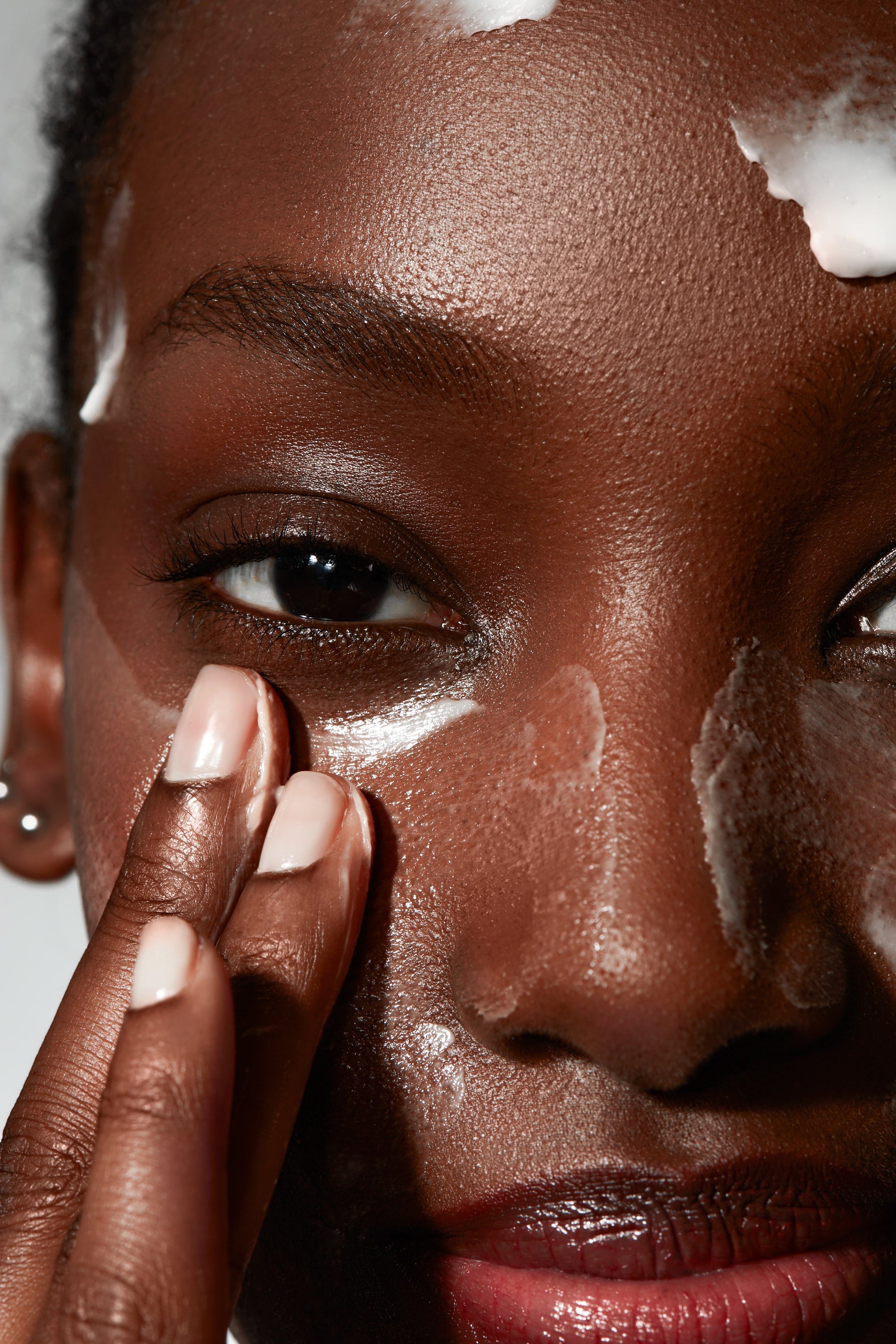 Why Hyperpigmentation Keeps Coming Back